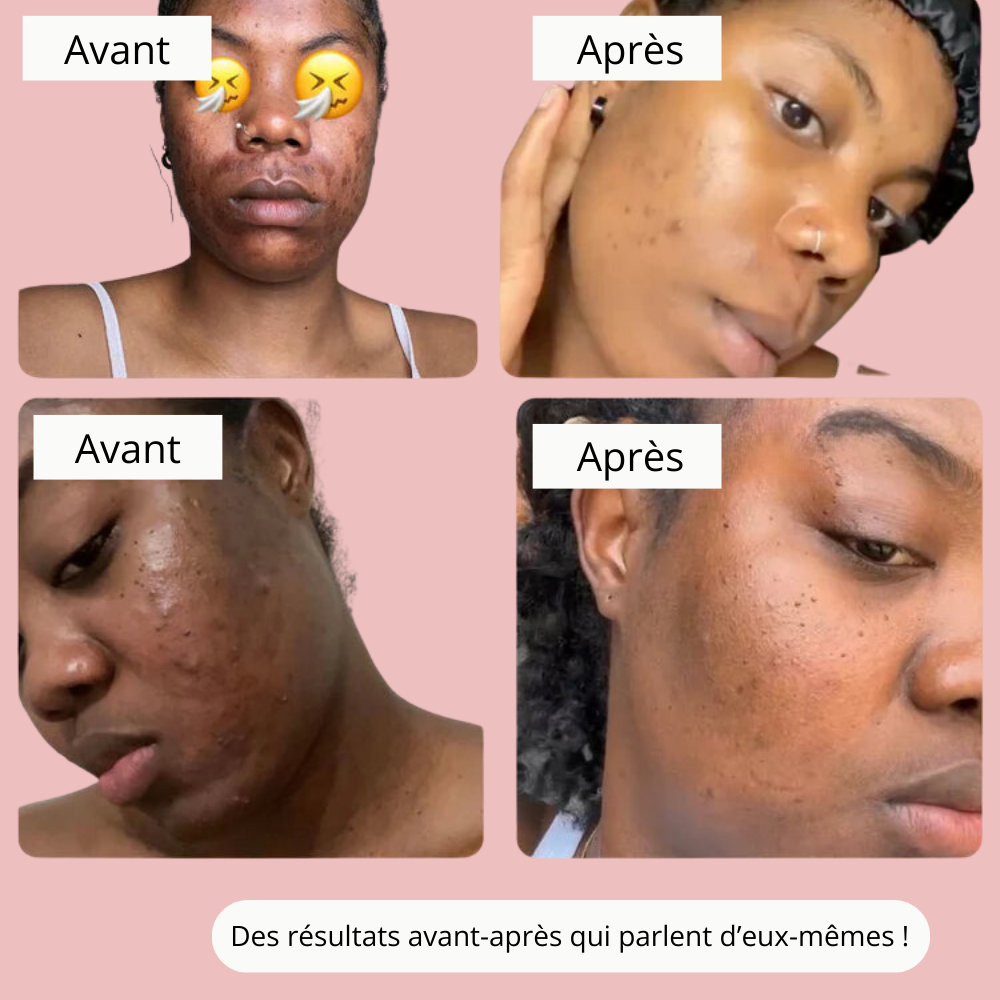 Instant Glow - Estompe les taches et aide à les prévenir