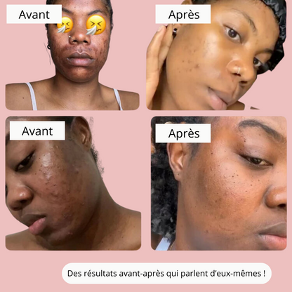 Instant Glow - Estompe les taches et aide à les prévenir