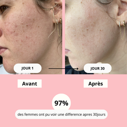 Instant Glow - Estompe les taches et aide à les prévenir