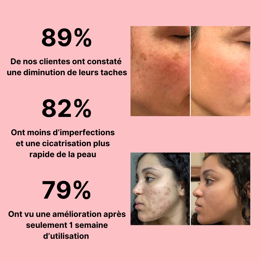 Instant Glow - Estompe les taches et aide à les prévenir